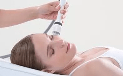 Microchanneling + RF + PRF