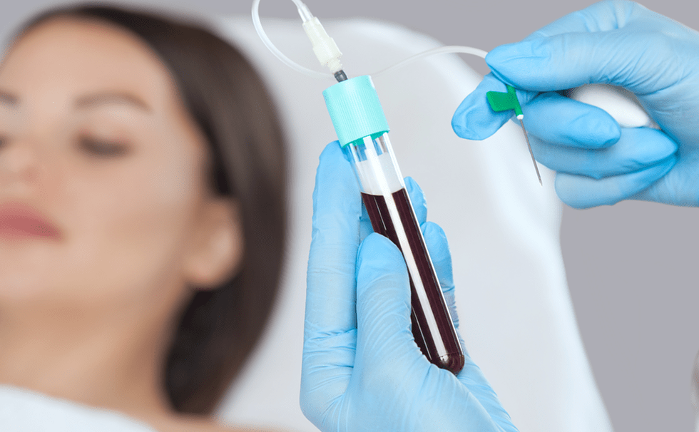 PRF Skin Rejuvenation