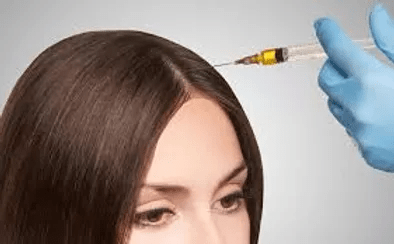 PRP Hair Restoration