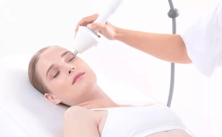 Radio Frequency (RF) Skin Tightening