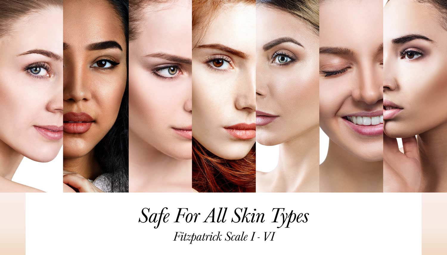 ViPeel-image_bigger