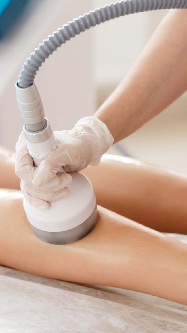 rf-body-contouring-image