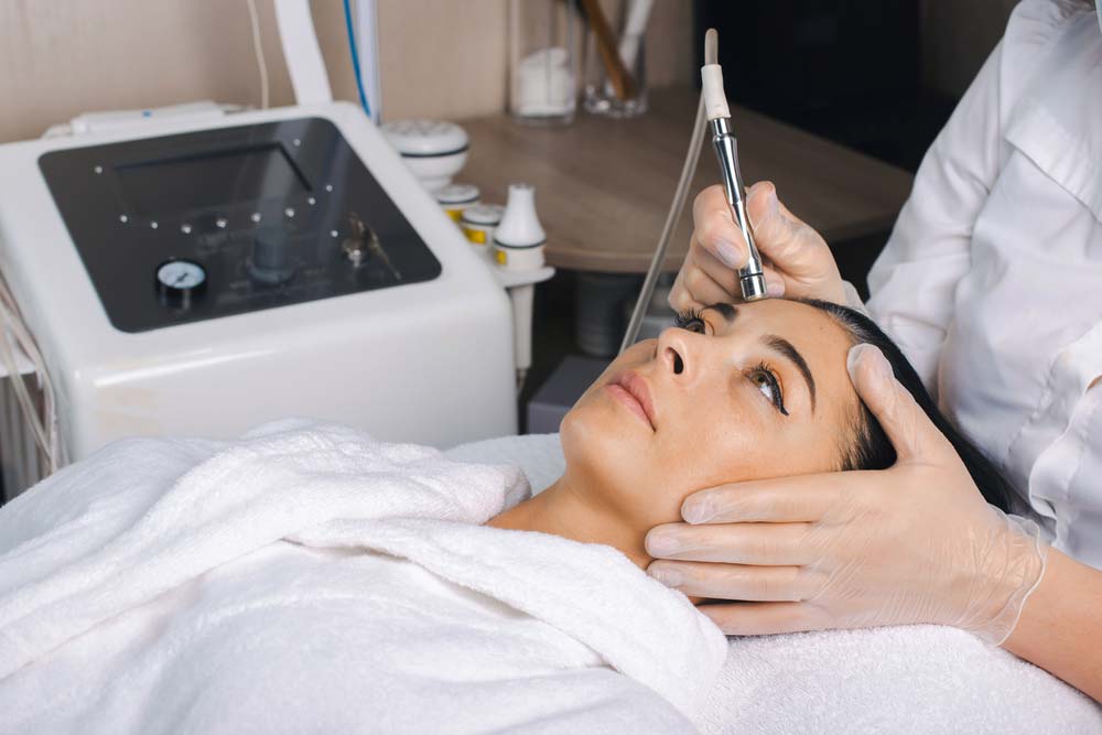 microneedling procedure